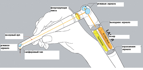 Light Instruments LiteTouch 3 - стоматологический эрбиевый лазер