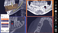 Exocad DICOM viewer - средство просмотра DICOM файлов
